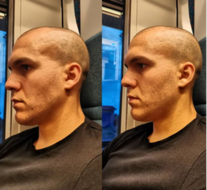 Skřípání zuby ze spaní může mít hned několik příčin