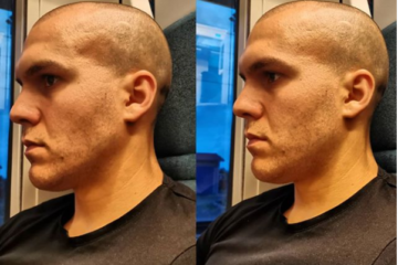 Skřípání zuby ze spaní může mít hned několik příčin