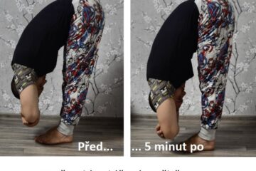 Baňkování v pohybu - srovnání před a po