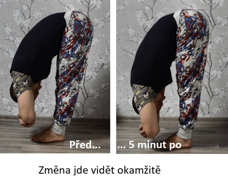 Baňkování v pohybu je technika, díky níž lze zvětšit rozsah pohybu během pár minut